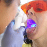 Oral Cancer Screenings