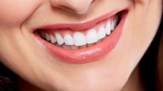 Smile Makeovers