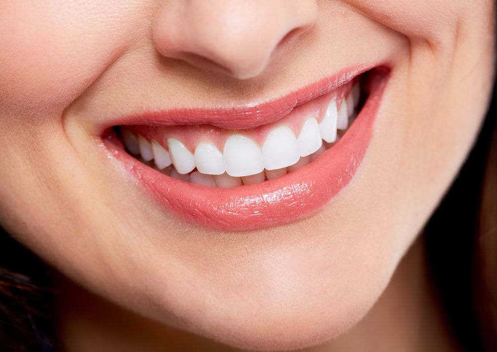 Smile Makeovers