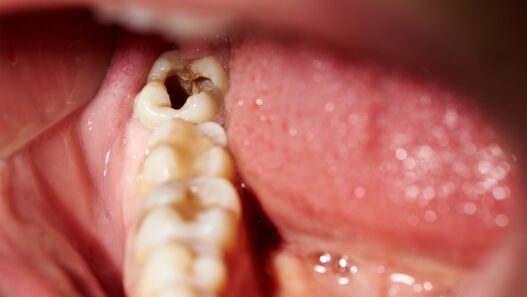 Oral Health Issues