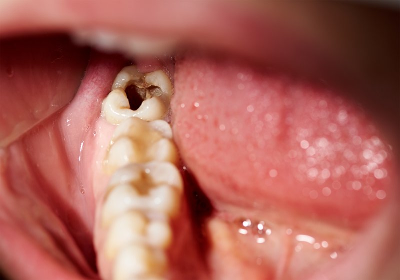 Oral Health Issues