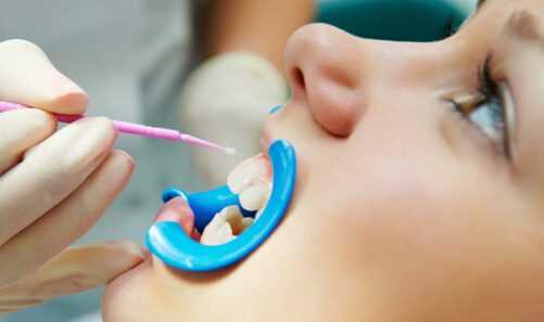 Preventive Dentistry Plays