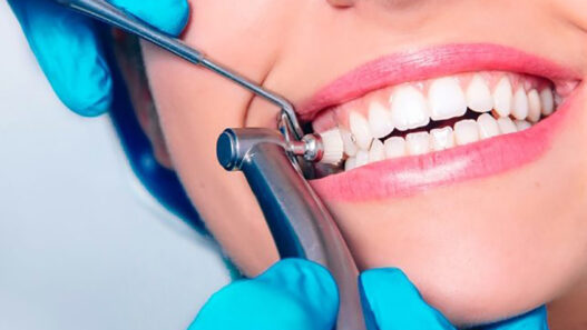 General Dentistry Services