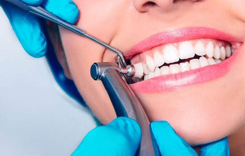 General Dentistry Services