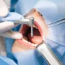 Oral Surgery In Implant Dentistry