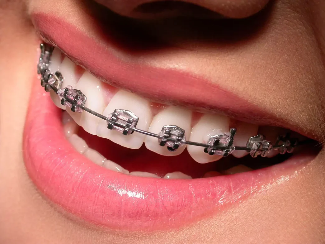 Orthodontics