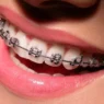 Orthodontics