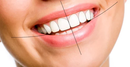 Why Smile Design Requires Both Cosmetic And Restorative Expertise