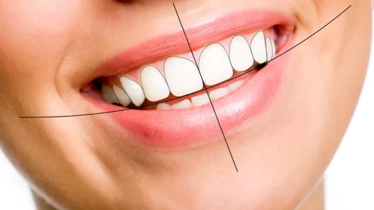 Why Smile Design Requires Both Cosmetic And Restorative Expertise