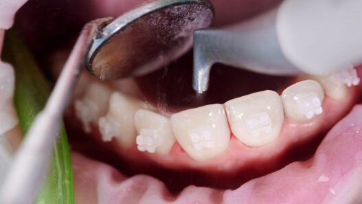 Regular Cleanings Support