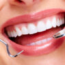 Cosmetic Dentistry