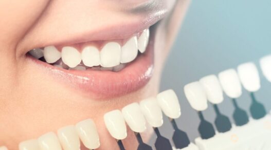 Why General Dentistry Is The Foundation For Every Cosmetic Smile Makeover
