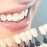 Why General Dentistry Is The Foundation For Every Cosmetic Smile Makeover