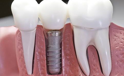 Cosmetic Dental Care