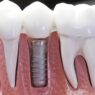 Cosmetic Dental Care