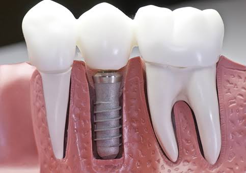 Cosmetic Dental Care