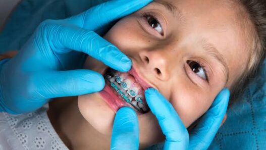 Kids And Braces