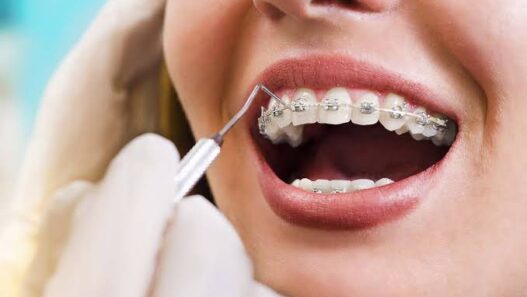 Orthodontic Services