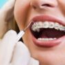 Orthodontic Services