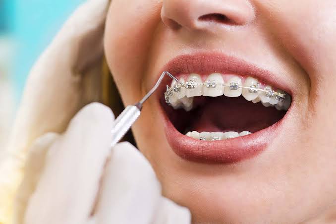 Orthodontic Services