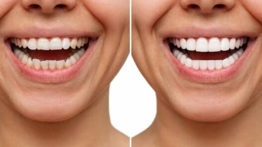 Choosing Between Cosmetic Enhancement And Functional Repair For A Damaged Tooth