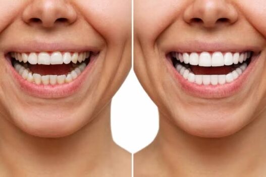 Choosing Between Cosmetic Enhancement And Functional Repair For A Damaged Tooth
