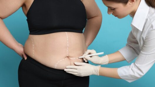 The Medical Screening That Happens Before Lipo Gets Approved