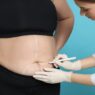 The Medical Screening That Happens Before Lipo Gets Approved